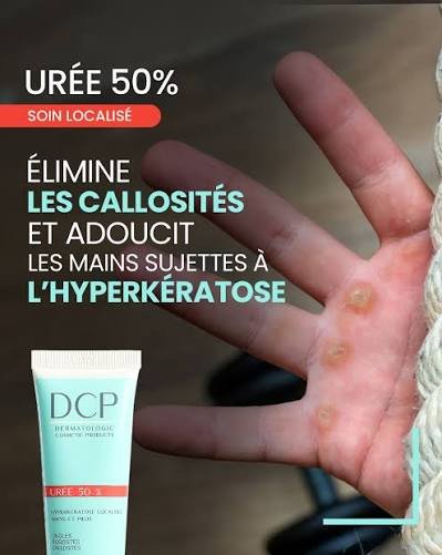 DCP UREE 50% HYPERKERATOSE LOCALISEE MAINS ET PIEDS 30 ML